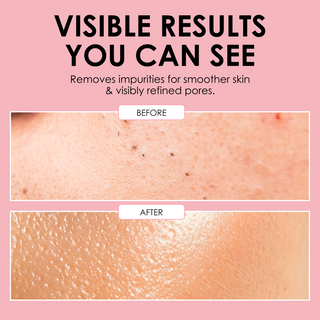 Porefection Clear Skin Set